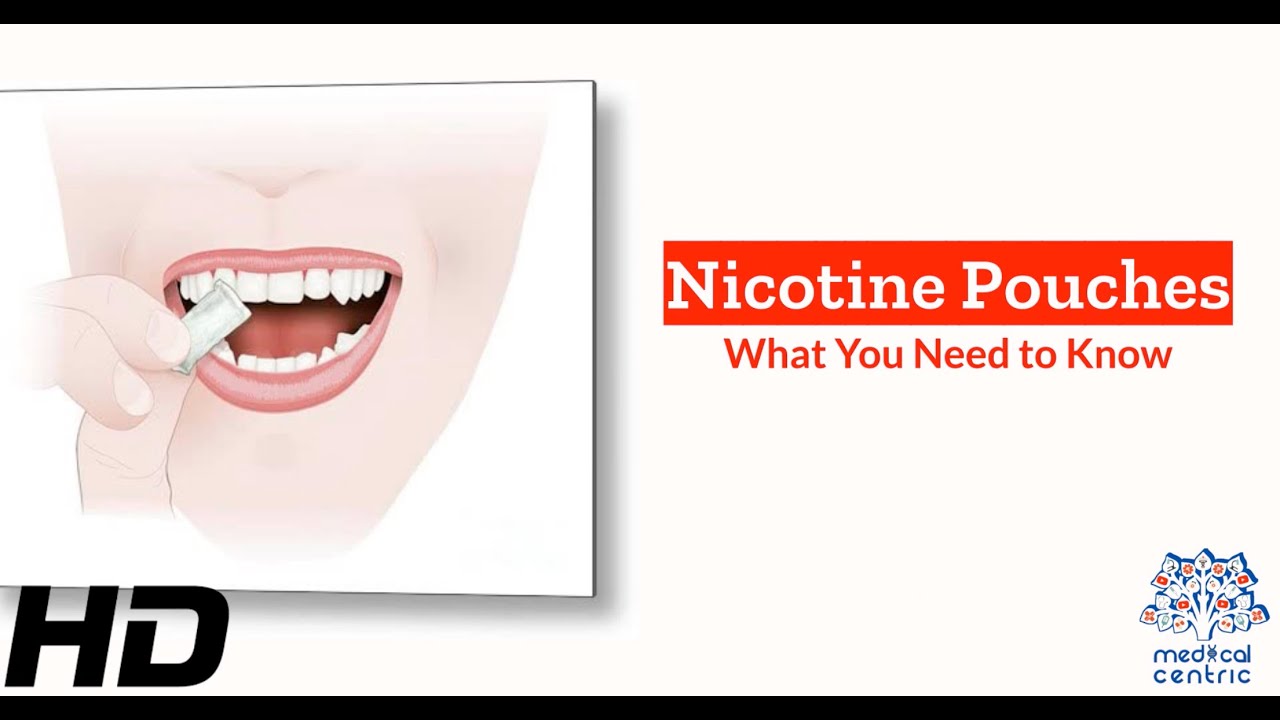 What Are The Best Nicotine Pouches? – Nicotine Pouch Guide